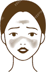 赤ら顔