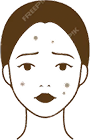 しみ